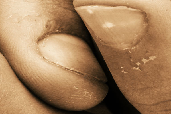 Split - click for previous